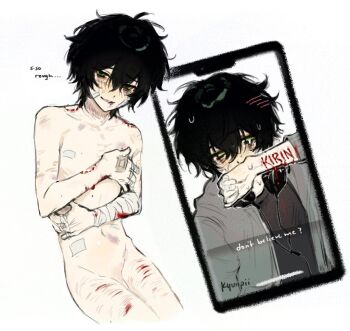 1boy bandage_on_cheek bandage_on_finger bandaged_arm bandaged_hand bandages bandaid bite_mark bite_mark_on_shoulder black_hair blood blush bruise completely_nude cuts degrees_of_lewdity english_text flaccid green_eyes headphones headphones_around_neck injury jacket koinurin kylar_(degrees_of_lewdity) kylar_(male)_(degrees_of_lewdity) looking_at_viewer male_focus multiple_scars multiple_views nude reverse_ryona scar scratches self-harm short_hair simple_background smile snapchat sweat white_background