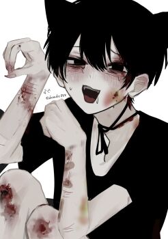 1boy :d animal_ears artist_name bags_under_eyes bandaid bandaid_on_arm bishounen black_eyes black_hair black_ribbon black_shirt bleeding blood blood_in_hair blood_on_arm blood_on_face blood_on_hands blood_on_neck bloody_tears blush bruise bruise_on_arm bruise_on_knee bruise_on_leg bruise_on_neck bruise_on_wrist cheek_injury crew_neck cuts daaade888 drooling empty_eyes fake_animal_ears fingernails furrowed_brow hair_between_eyes hand_injury hands_up highres injury knee_injury knees_up long_fingernails looking_at_viewer male_focus neck_ribbon open_mouth original paw_pose ribbon self-harm self-harm_scar shirt short_hair short_sleeves sidelocks signature simple_background sitting smile solo sweat too_many_bandaids twitter_username upper_body variant_set wavy_mouth white_background wrist_cutting