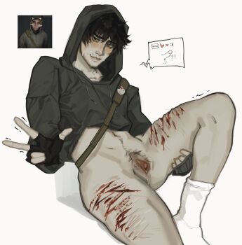 1boy :3 ? black_gloves black_hoodie bleeding blood blush body_hair charluiu collarbone crop_top cry_of_fear cum cum_on_body cuntboy cuts deep_wound embarrassed facial female_pubic_hair fingerless_gloves gloves heart hello_kitty_print highres hood hoodie injury long_sleeves male_focus multiple_scars penis_doodle pubic_hair pussy_juice razor_blade scar self-harm self-harm_scar short_hair shoulder_strap simon_henriksson socks spread_legs thigh_cutting white_background white_socks