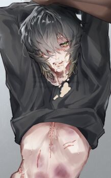 2boys bruise highres injury male_focus multiple_boys rkgkzatto_(artist) scar scar_on_chest scar_on_face slow_damage towa_(slow_damage) vomit