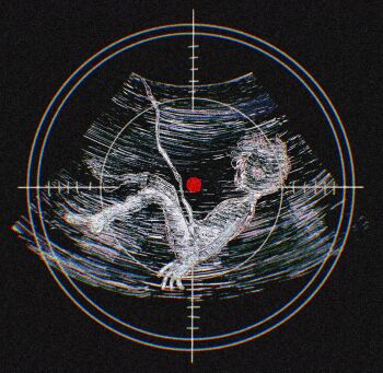 1other abortion ambiguous_gender commentary curled_up english_commentary fetus from_side full_body highres looking_through_scope original pov revol4357 short_hair solo umbilical_cord