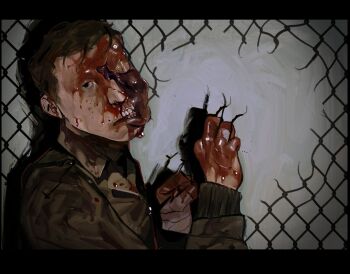 1boy bandaged_hand bandages black_eyes blood blood_on_face blood_on_hands body_horror broken_fence broken_skin broken_skull brown_coat brown_hair coat exhausted exposed_bone guro highres injury looking_at_viewer male_focus missing_eye original popped_collar recosks solo swollen teeth upper_body wire_fence