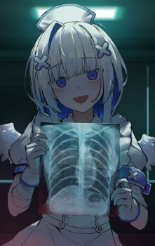 1girl amane_kanata amane_kanata_(nurse) angel angel_wings apron bandaged_arm bandages blue_hair colored_inner_hair crazy crazy_eyes dress empty_eyes feathered_wings frilled_apron frills gloves grey_hair hair_ornament halo hat highres hololive hospital id_card kaguya_(srx61800) lanyard long_hair looking_at_viewer mini_wings multicolored_hair nurse nurse_cap official_alternate_hair_length official_alternate_hairstyle open_mouth purple_eyes shaded_face single_hair_intake smile solo star_halo streaked_hair virtual_youtuber white_apron white_gloves white_wings wings x-ray x_hair_ornament