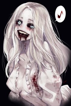 1girl absurdres blood blood_from_mouth blood_on_clothes bloodshot_eyes breasts colored_sclera covered_erect_nipples crazy_eyes crazy_smile highres kivo light_blush musical_note no_bra open_clothes pale_skin red_sclera resident_evil resident_evil_requiem selena_corey smile solo spoken_musical_note upper_body white_hair wide_mouth zombie zombie_girl