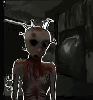 1boy bald blood blood_on_face sawer_(cry_of_fear) skinny