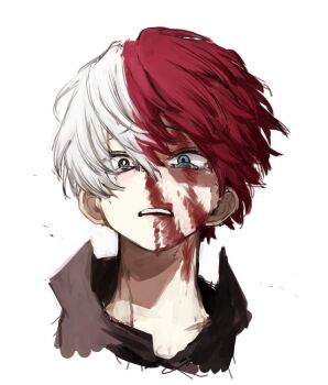 Rule 34 | 1boy, black shirt, blood, blood on face, blue eyes, bn 56s, boku no hero academia, brown eyes, collared shirt, commentary request, cropped shoulders, heterochromia, injury, male focus, multicolored hair, open mouth, popped collar, red hair, shirt, simple background, sketch, solo, split-color hair, tearing up, tears, teeth, todoroki shoto, white background, white hair