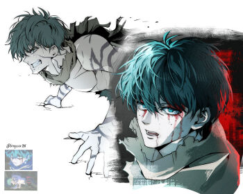 Rule 34 | 1boy, blood, blood on face, boku no hero academia, cape, clenched teeth, freckles, green eyes, green hair, hair between eyes, highres, kingxxxx715, looking at viewer, male focus, midoriya izuku, multiple scars, multiple views, reference inset, scar, short hair, simple background, sweat, teeth, topless male, twitter username, white background, yellow cape