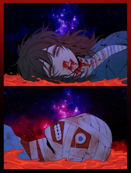 1boy 1girl anya_(mouthwashing) bandaged_head bandages black_hair blood blood_from_mouth blood_on_clothes blood_on_face blue_eyes crying curly_(mouthwashing) curly_(post-crash)_(mouthwashing) disfigured grey_eyes grin highres looking_at_viewer lying medium_hair mouthwashing no_lips nosebleed on_back shirt sky smile split_screen star_(sky) starry_sky striped_clothes striped_shirt turtleneck yp_katelove