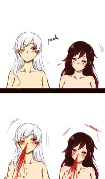 2girls alternate_hair_length alternate_hairstyle arrow_(symbol) blood blush brown_hair completely_nude kuma_(bloodycolor) looking_at_another looking_to_the_side multiple_girls nosebleed nude one_eye_closed ruby_rose rwby scar scar_across_eye scar_on_face simple_background weiss_schnee white_hair yuri