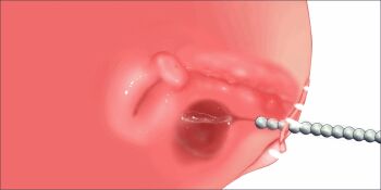 1girl animated animated_gif bar_censor bladder censored cervix clitoral_hood clitoris close-up cross-section deep_penetration kensuke7777 loli object_insertion pussy sex_toy simple_background sounding urethral_beads urethral_insertion uterus white_background x-ray