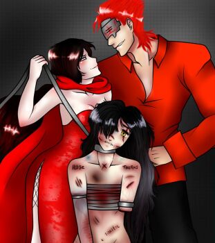 adam_taurus artist_request bad_source branded cinder_fall dress grey_eyes leash made_in_2017 mutilation presumed_creation_date red_dress red_shirt ruby_rose rwby scar sewn_mouth shirt skindentation tagme